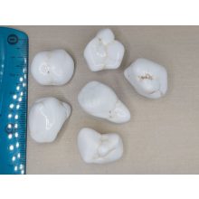 Magnezit marokkő közepes